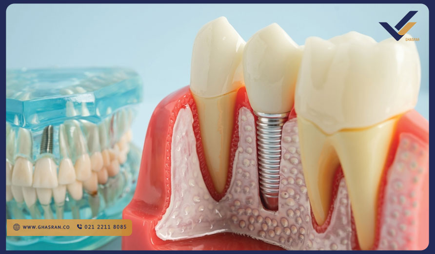 تحصیل دندان پزشکی